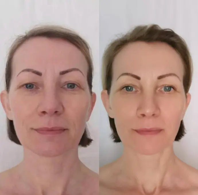 Yoga4Face mit Renée Isermann das passiert in der Trainerausbildung. Vorher Nachher Bild