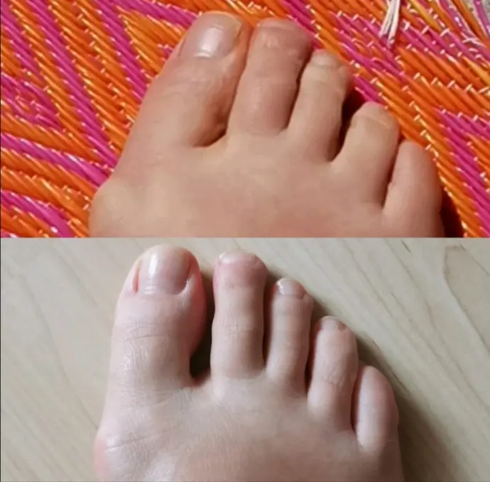 Yoga4Face mit Renée Isermann Dein Hallux ist Dir ins Gesicht geschrieben, Gesichtsyoga, Körperhaltung, Deine Füße tragen Dich