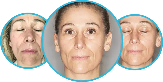 Renée Isermann – Yoga4Face Face Yoga